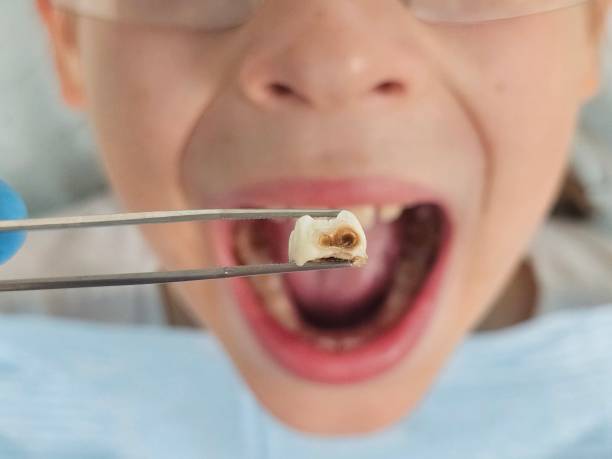 Best Weekend Emergency Dentist in Norton, VA